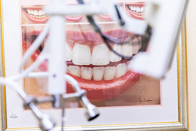 photo of a patient's teeth being whitened